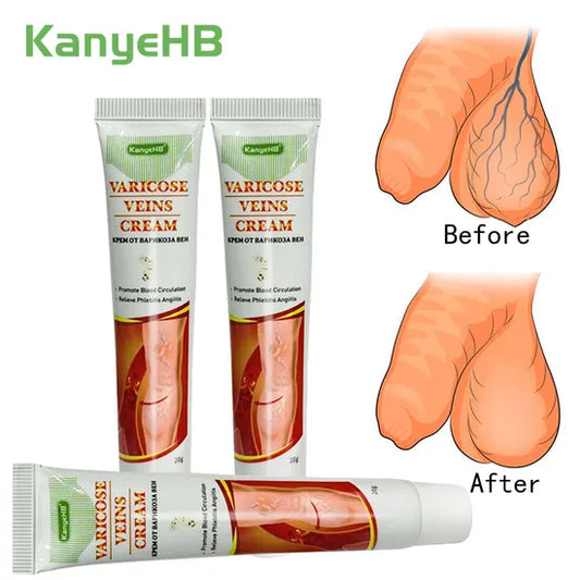 crèmes pour varices génitales